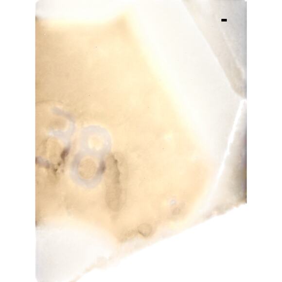 Golden Goose Francy Black High Tops Blue Stripe on Back Women's Sz. 38 (US 8) - Picture 9 of 9